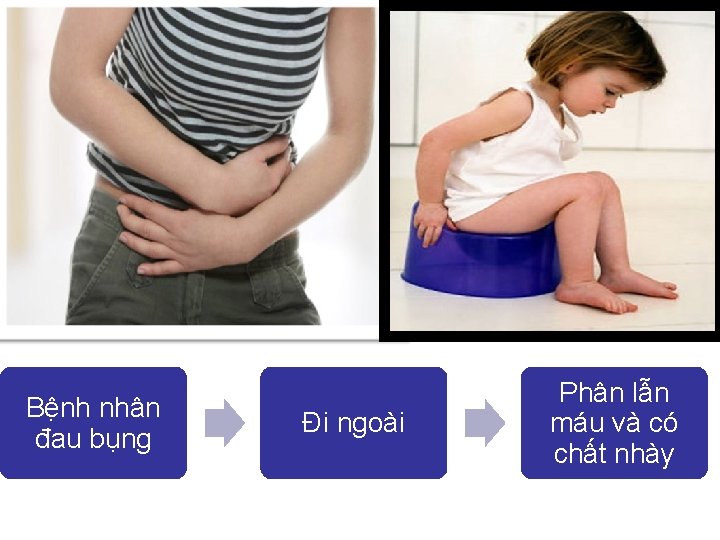 Bệnh nhân đau bụng Đi ngoài Phân lẫn máu và có chất nhày 