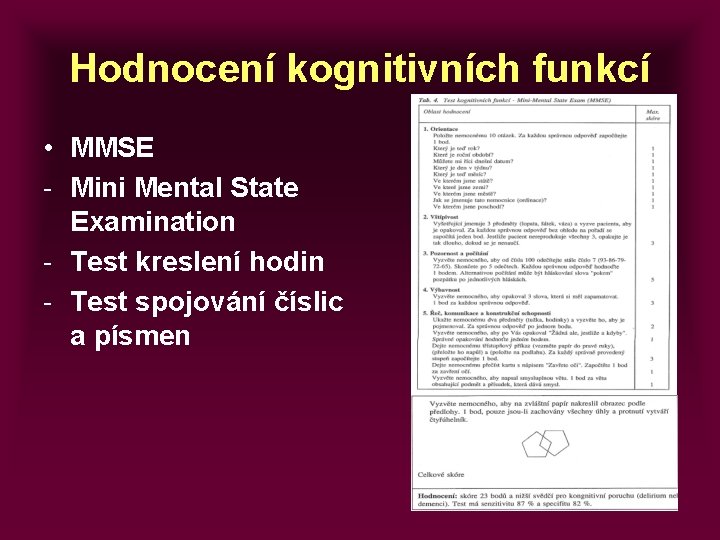 Hodnocení kognitivních funkcí • MMSE - Mini Mental State Examination - Test kreslení hodin