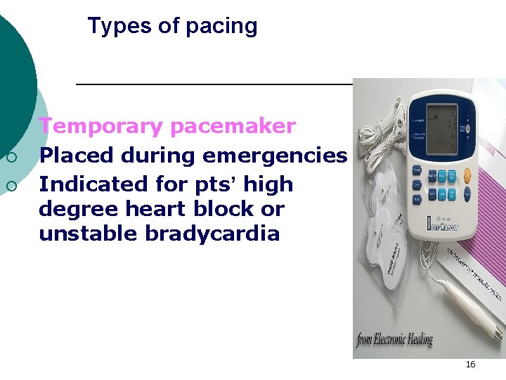 Types of pacing 2. ¡ ¡ Temporary pacemaker Placed during emergencies Indicated for pts’