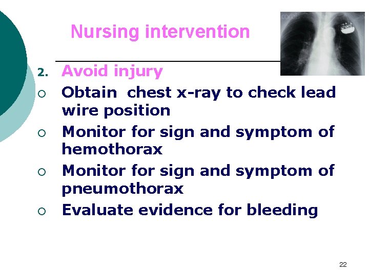 Nursing intervention 2. ¡ ¡ Avoid injury Obtain chest x-ray to check lead wire