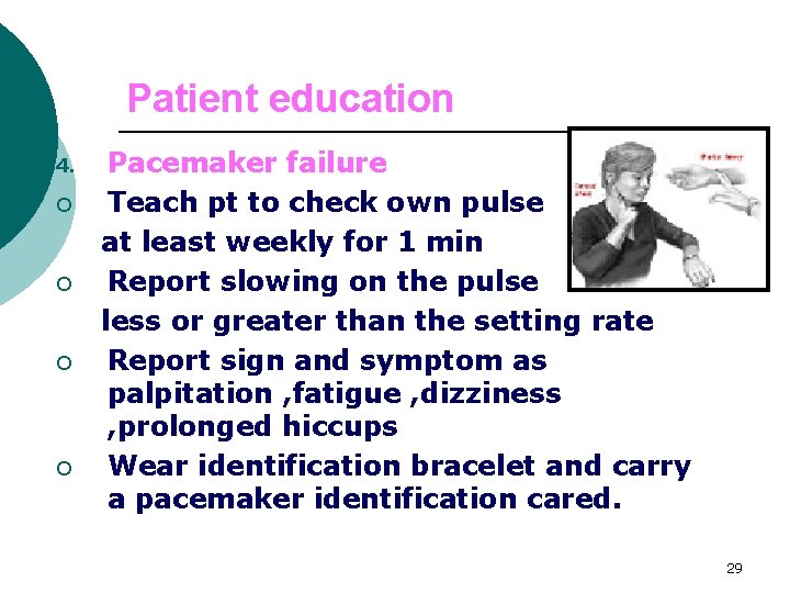 Patient education 4. ¡ ¡ Pacemaker failure Teach pt to check own pulse at