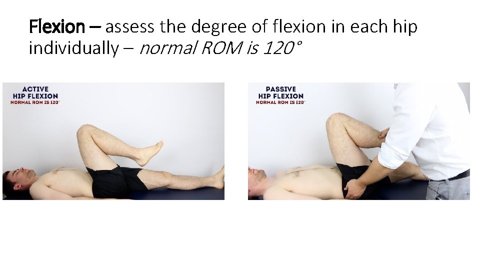Flexion – assess the degree of flexion in each hip individually – normal ROM Flexion – assess the degree of flexion in each hip individually – normal ROM