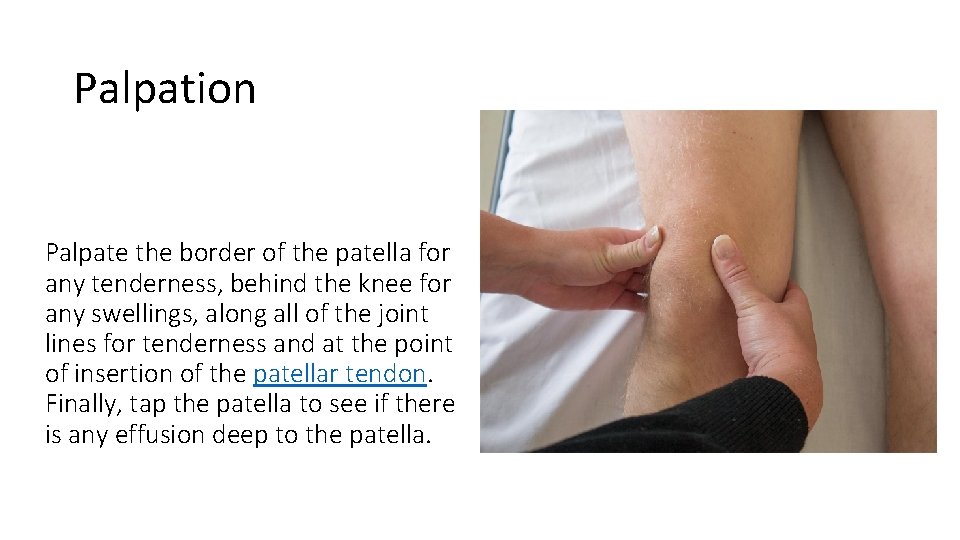 Palpation Palpate the border of the patella for any tenderness, behind the knee for Palpation Palpate the border of the patella for any tenderness, behind the knee for