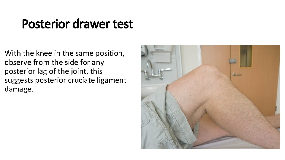 Posterior drawer test With the knee in the same position, observe from the side Posterior drawer test With the knee in the same position, observe from the side