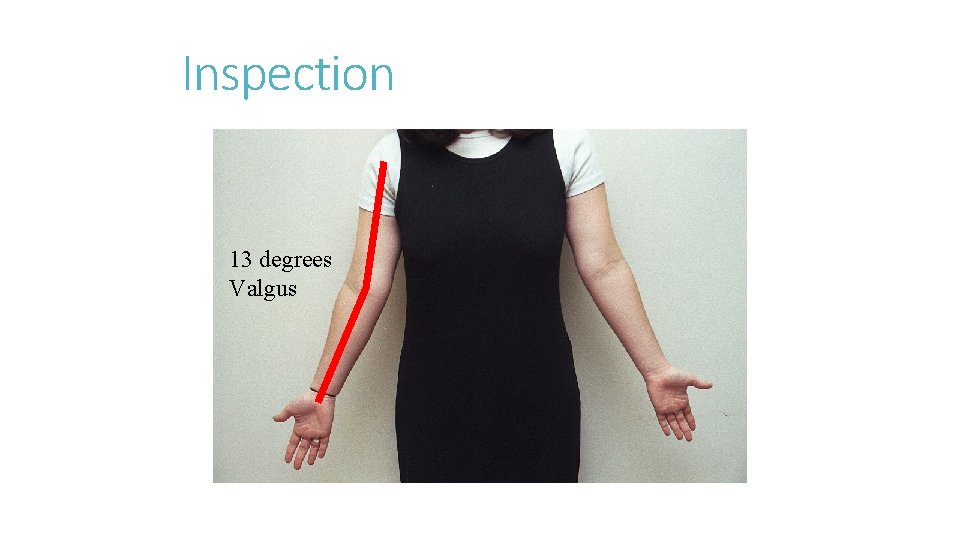 Inspection 13 degrees Valgus Inspection 13 degrees Valgus