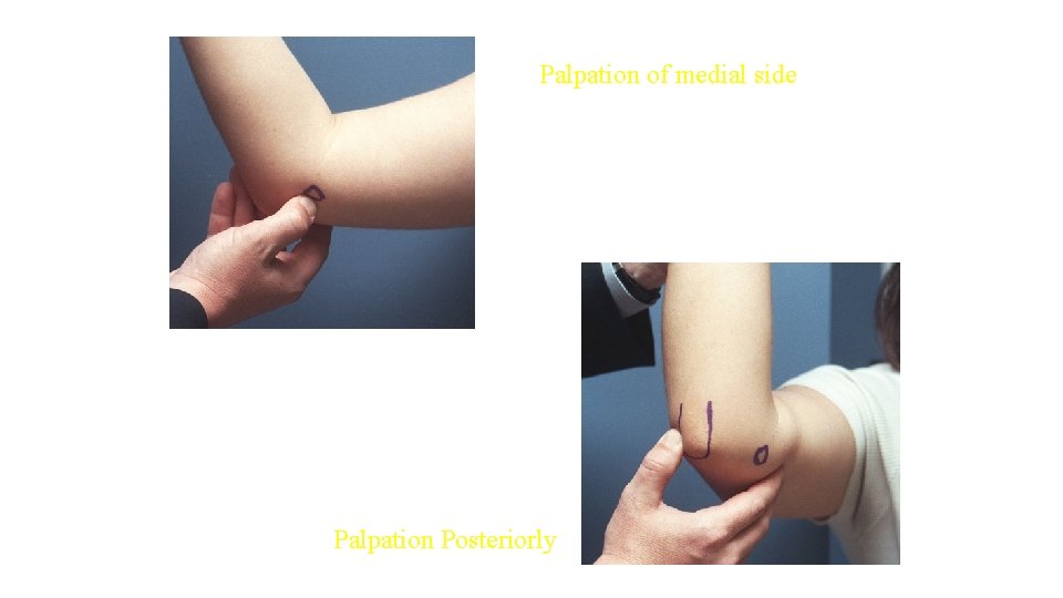 Palpation of medial side Palpation Posteriorly Palpation of medial side Palpation Posteriorly