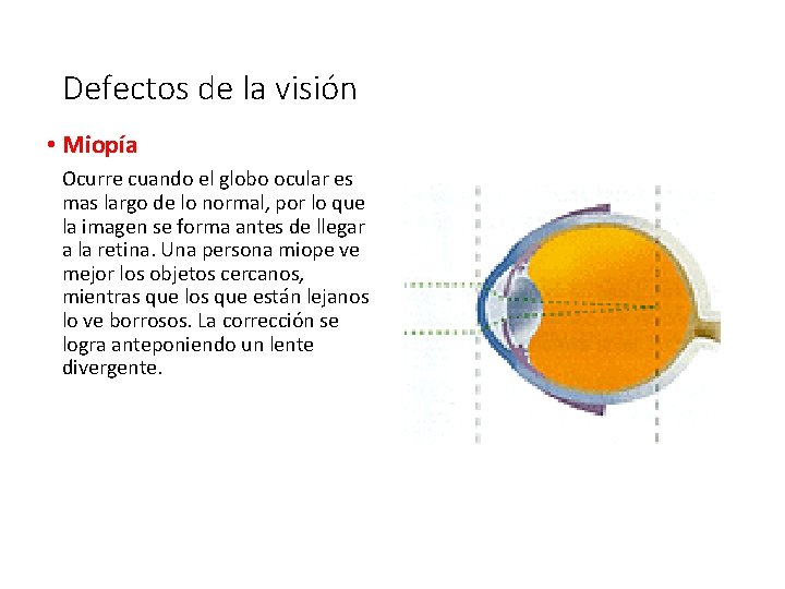 Defectos de la visión • Miopía Ocurre cuando el globo ocular es mas largo