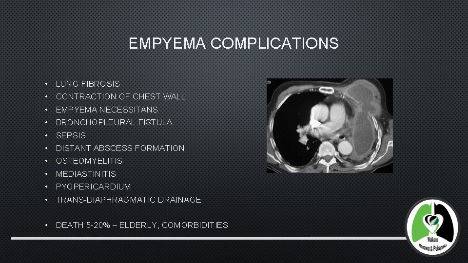 EMPYEMA COMPLICATIONS • LUNG FIBROSIS • CONTRACTION OF CHEST WALL • EMPYEMA NECESSITANS •