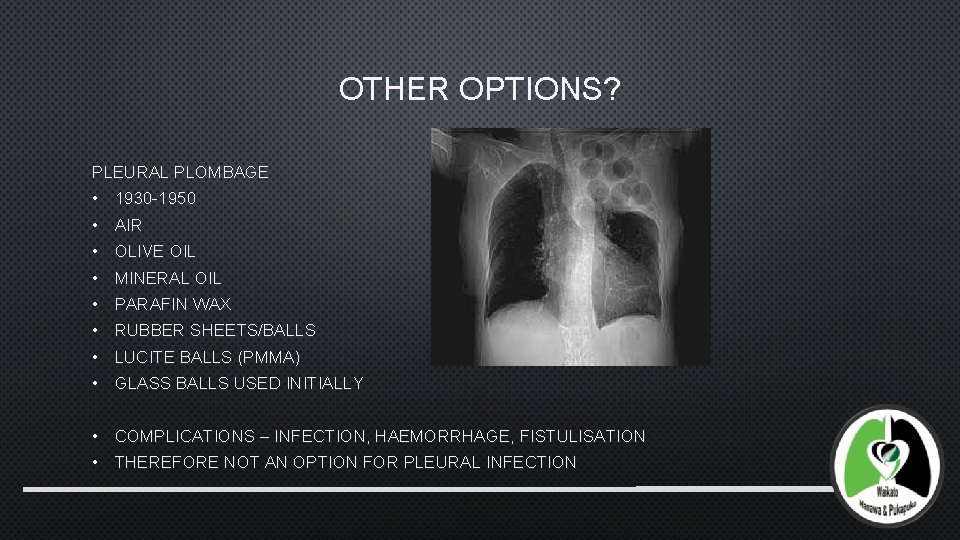 OTHER OPTIONS? PLEURAL PLOMBAGE • 1930 -1950 • AIR • OLIVE OIL • MINERAL