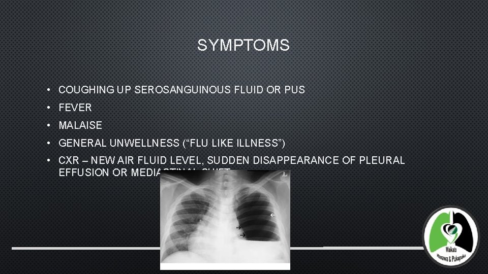 SYMPTOMS • COUGHING UP SEROSANGUINOUS FLUID OR PUS • FEVER • MALAISE • GENERAL