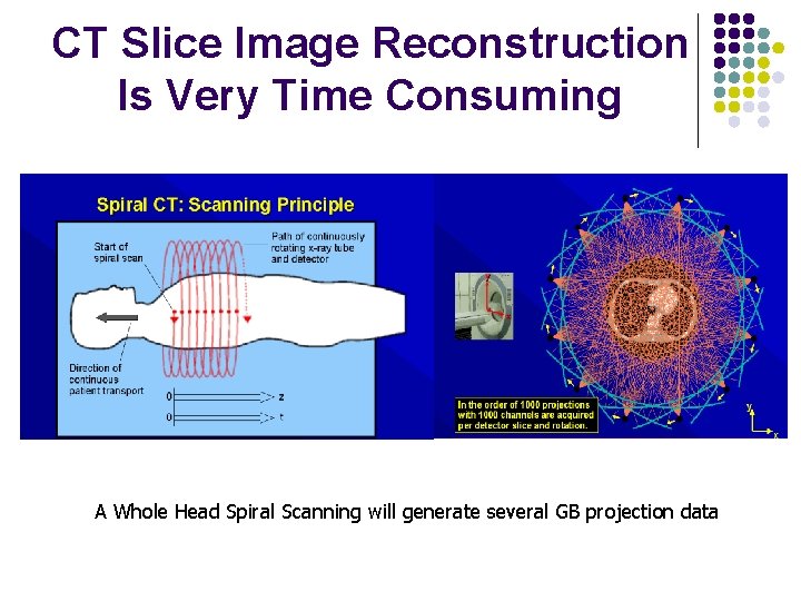 CT Slice Image Reconstruction Is Very Time Consuming A Whole Head Spiral Scanning will