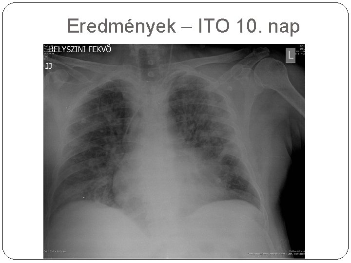 Eredmények – ITO 10. nap 