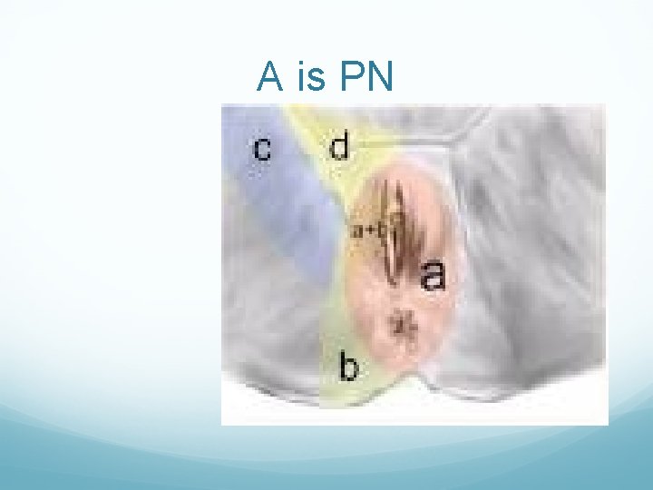 A is PN A is PN