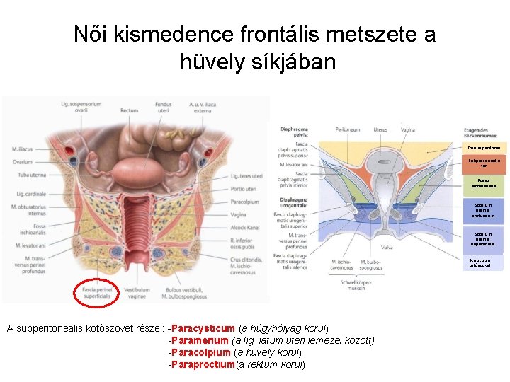 Női kismedence frontális metszete a hüvely síkjában Cavum peritonei Subperitonealis tér Fossa ischioanalis Spatium