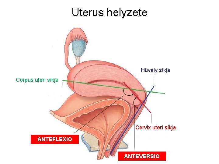 Uterus helyzete Hüvely síkja Corpus uteri síkja Cervix uteri síkja ANTEFLEXIO ANTEVERSIO 