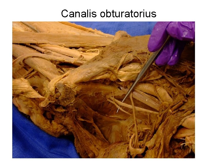 Canalis obturatorius 