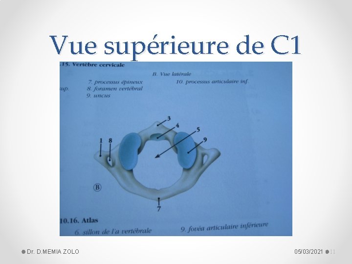 Vue supérieure de C 1 Dr. D. MEMIA ZOLO 05/03/2021 11 