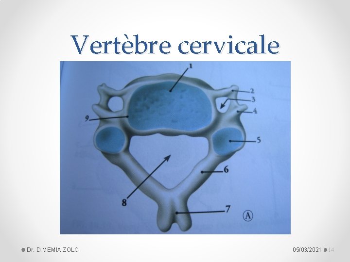 Vertèbre cervicale Dr. D. MEMIA ZOLO 05/03/2021 14 