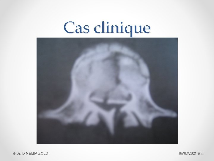 Cas clinique Dr. D. MEMIA ZOLO 05/03/2021 35 