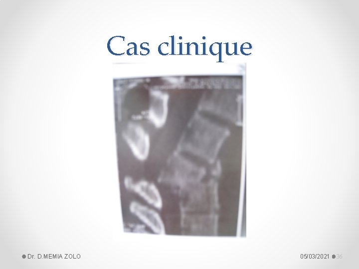 Cas clinique Dr. D. MEMIA ZOLO 05/03/2021 36 