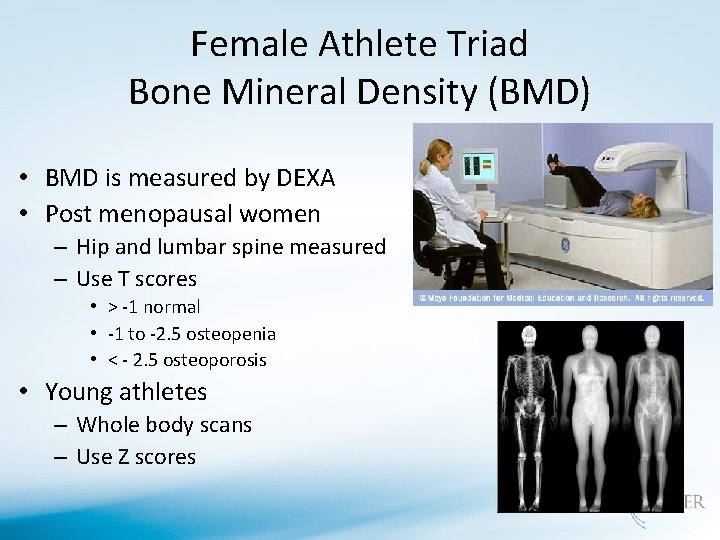 Female Athlete Triad Bone Mineral Density (BMD) • BMD is measured by DEXA •