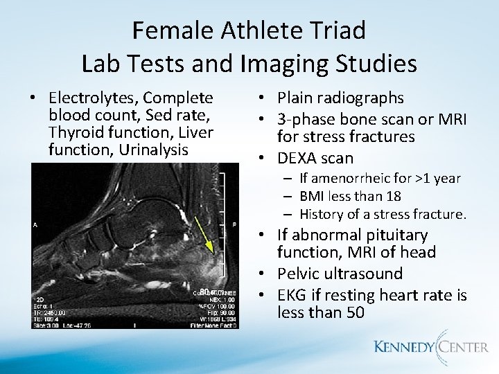 Female Athlete Triad Lab Tests and Imaging Studies • Electrolytes, Complete blood count, Sed