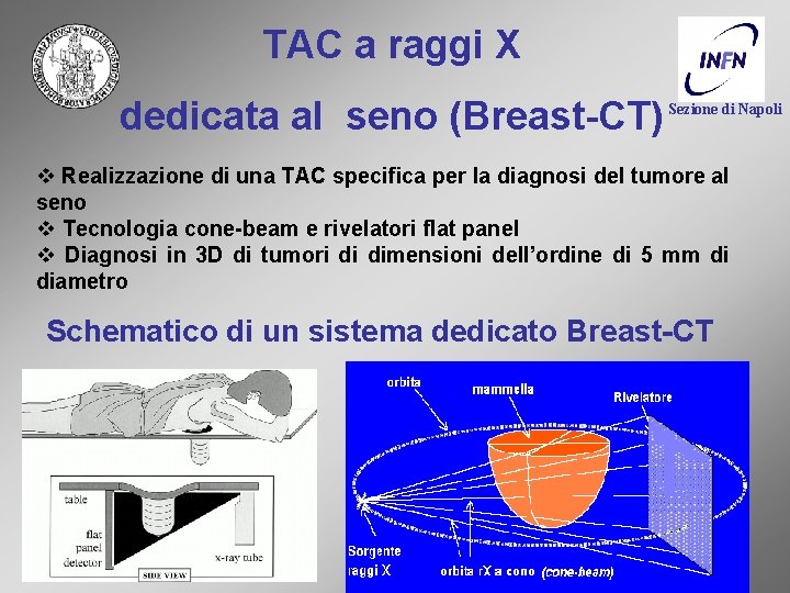 TAC a raggi X dedicata al seno (Breast-CT) Sezione di Napoli v Realizzazione di