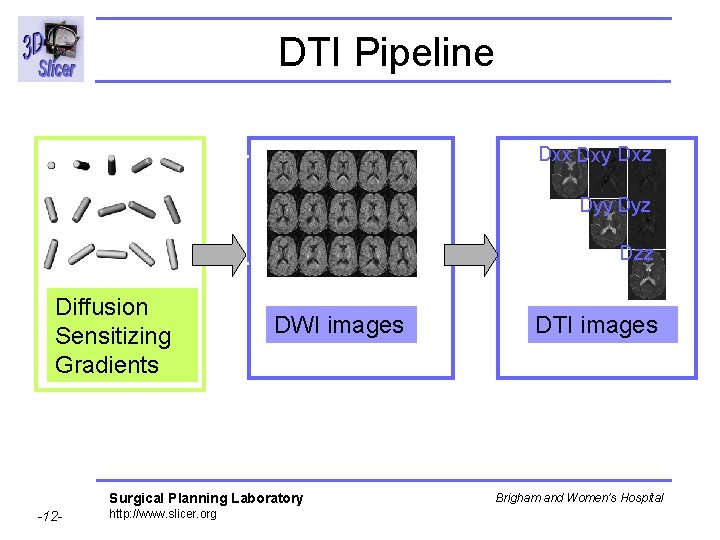 DTI Pipeline Dxx Dxy Dxz Dyy Dyz Dzz Diffusion Sensitizing Gradients DWI images Surgical