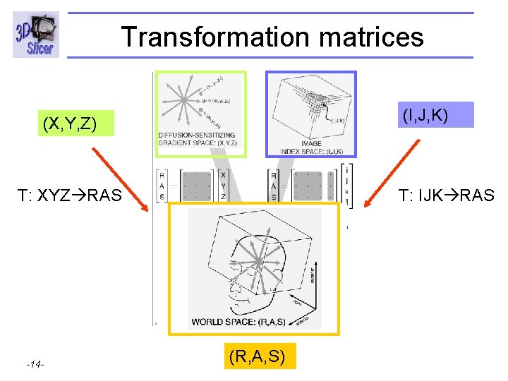 Transformation matrices (I, J, K) (X, Y, Z) T: XYZ RAS Surgical Planning Laboratory
