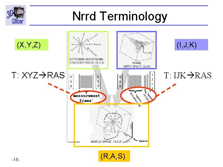 Nrrd Terminology (X, Y, Z) (I, J, K) T: XYZ RAS Surgical Planning Laboratory