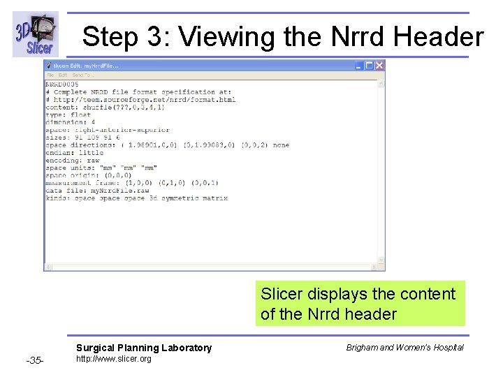 Step 3: Viewing the Nrrd Header Slicer displays the content of the Nrrd header