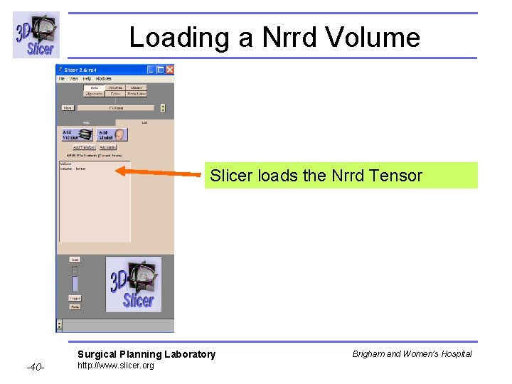 Loading a Nrrd Volume Slicer loads the Nrrd Tensor Surgical Planning Laboratory -40 -