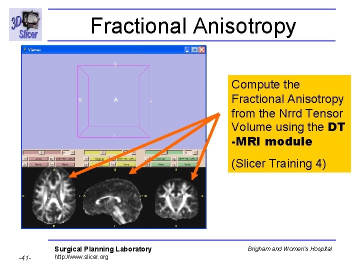 Fractional Anisotropy Compute the Fractional Anisotropy from the Nrrd Tensor Volume using the DT