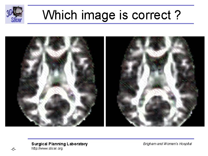 Which image is correct ? Surgical Planning Laboratory -6 - http: //www. slicer. org