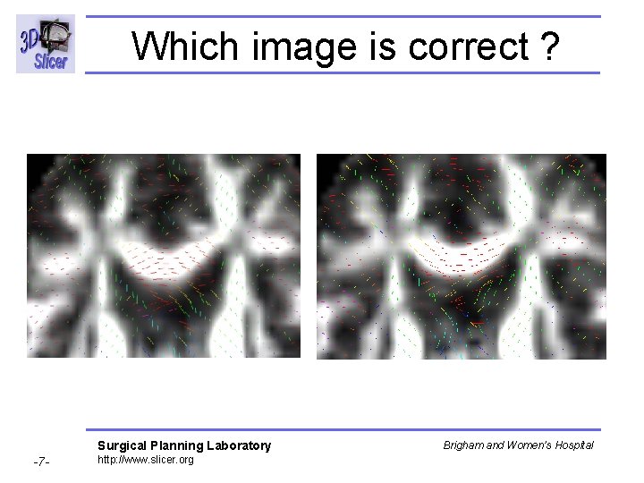 Which image is correct ? Surgical Planning Laboratory -7 - http: //www. slicer. org