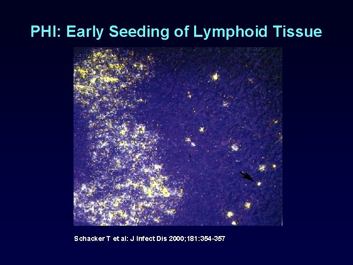 PHI: Early Seeding of Lymphoid Tissue Schacker T et al: J Infect Dis 2000;