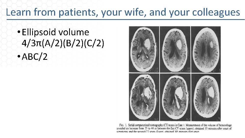 Learn from patients, your wife, and your colleagues • Ellipsoid volume 4/3π(A/2)(B/2)(C/2) • ABC/2