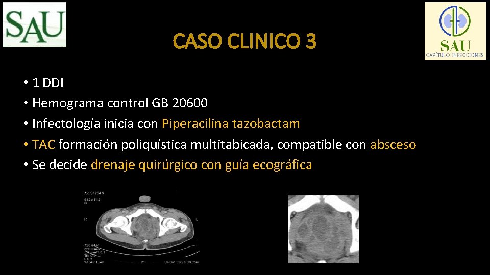 CASO CLINICO 3 • 1 DDI • Hemograma control GB 20600 • Infectología inicia