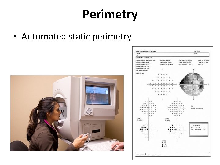 Perimetry • Automated static perimetry 