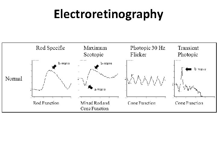 Electroretinography 