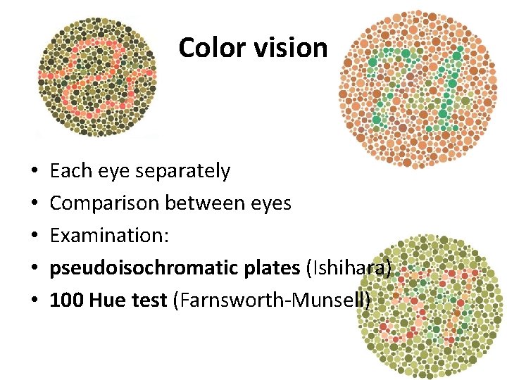 Color vision • • • Each eye separately Comparison between eyes Examination: pseudoisochromatic plates