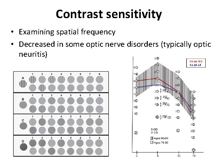 Contrast sensitivity • Examining spatial frequency • Decreased in some optic nerve disorders (typically