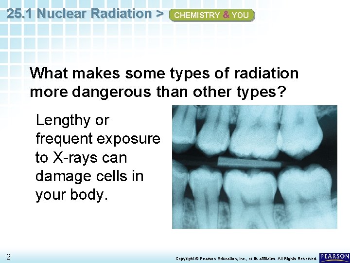 25. 1 Nuclear Radiation > CHEMISTRY & YOU What makes some types of radiation