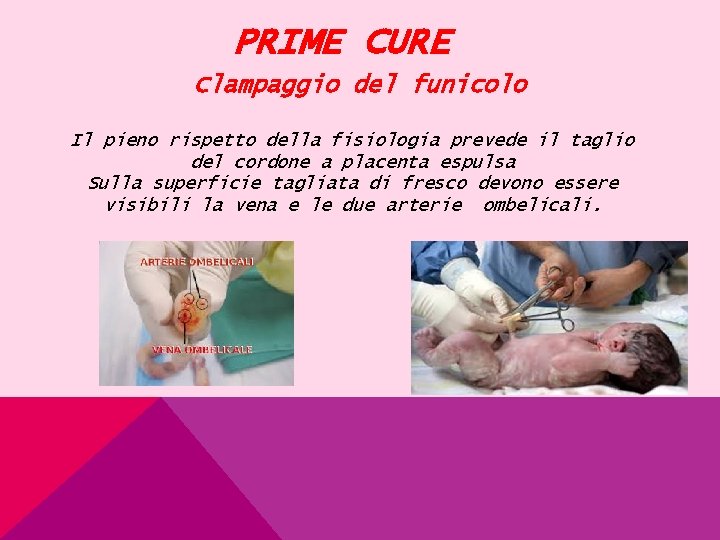 PRIME CURE Clampaggio del funicolo Il pieno rispetto della fisiologia prevede il taglio del