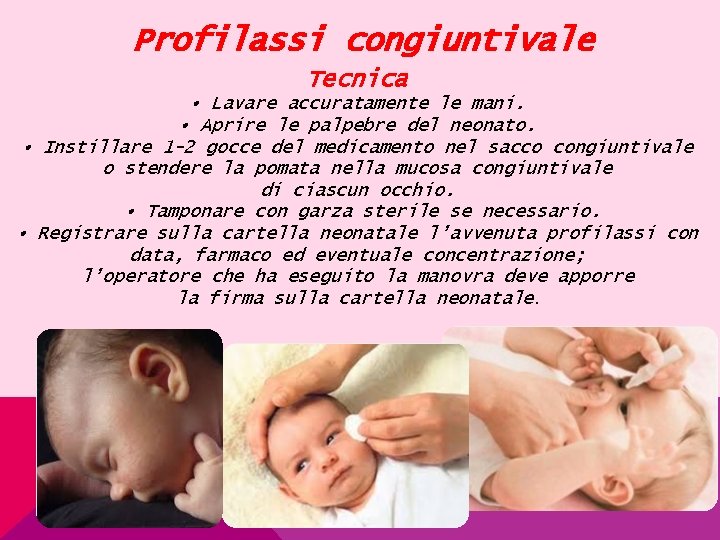 Profilassi congiuntivale Tecnica • Lavare accuratamente le mani. • Aprire le palpebre del neonato.