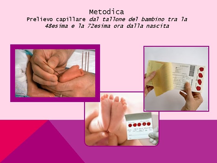 Metodica Prelievo capillare dal tallone del bambino tra la 48 esima e la 72