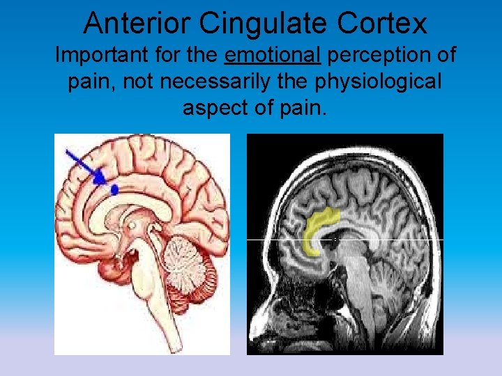 Anterior Cingulate Cortex Important for the emotional perception of pain, not necessarily the physiological