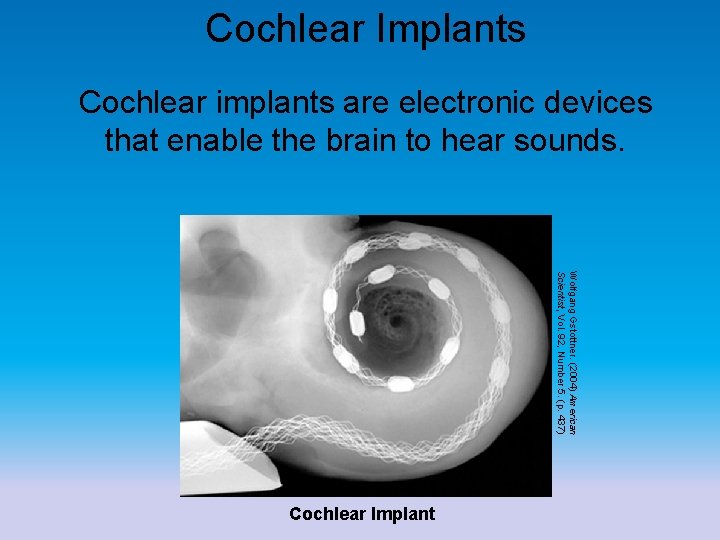Cochlear Implants Cochlear implants are electronic devices that enable the brain to hear sounds.