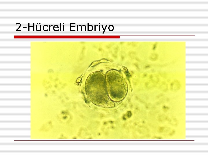 2 -Hücreli Embriyo 