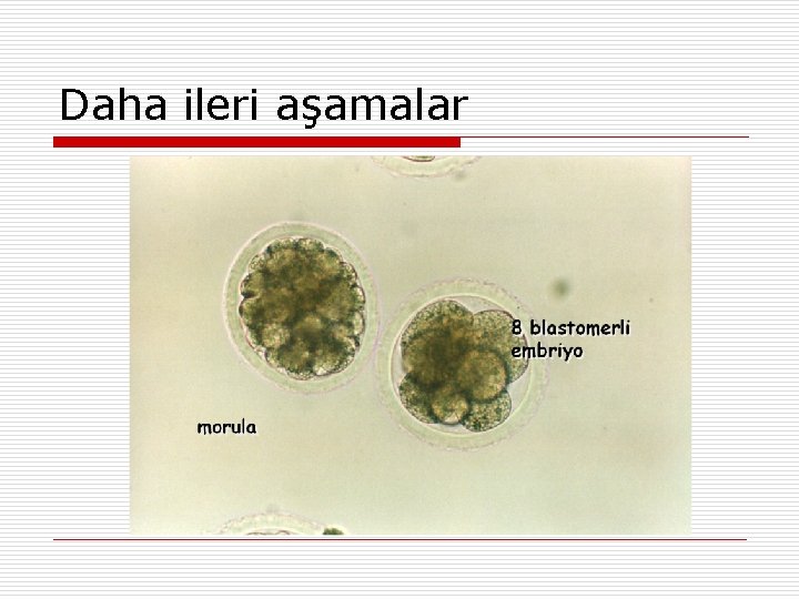 Daha ileri aşamalar 